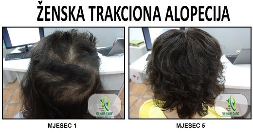 101 Hair Clinic - 101 Hair Clinic