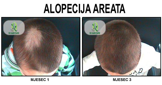 101 Hair Clinic - 101 Hair Clinic