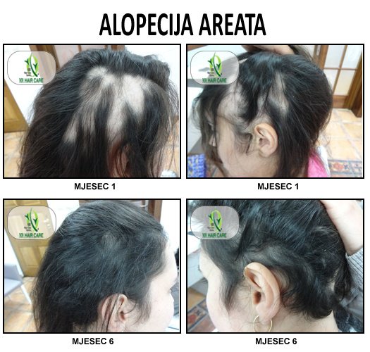 101 Hair Clinic - 101 Hair Clinic