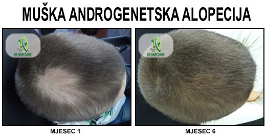 101 Hair Clinic - 101 Hair Clinic