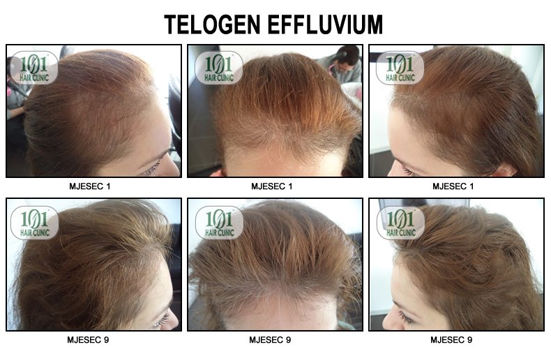 101 Hair Clinic - 101 Hair Clinic