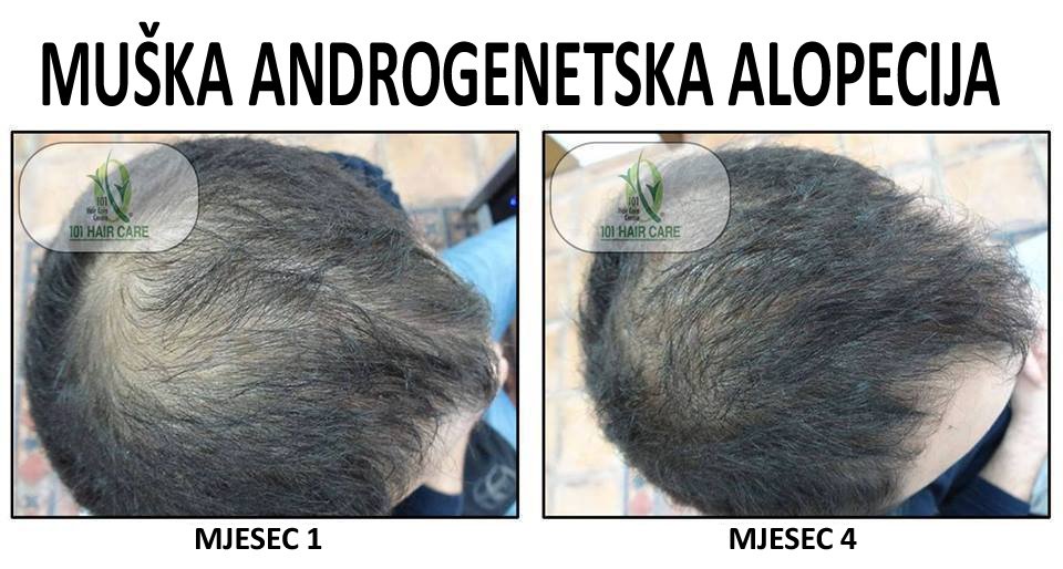 101 Hair Clinic - 101 Hair Clinic