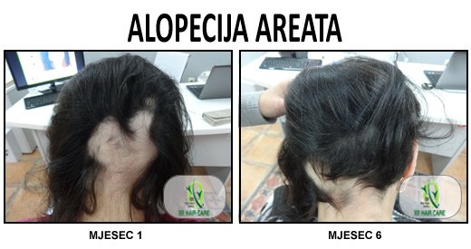 101 Hair Clinic - 101 Hair Clinic