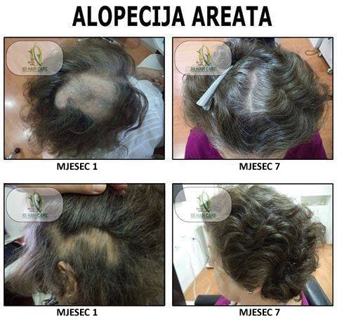 101 Hair Clinic - 101 Hair Clinic