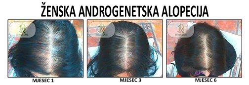 101 Hair Clinic - 101 Hair Clinic