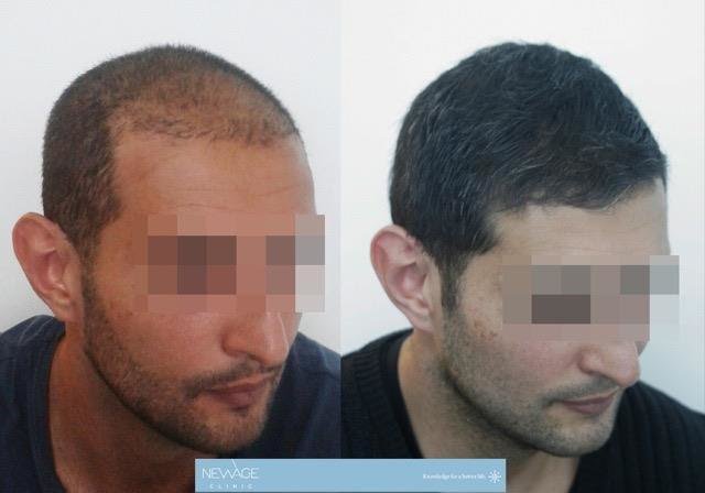 101 Hair Clinic - 101 Hair Clinic