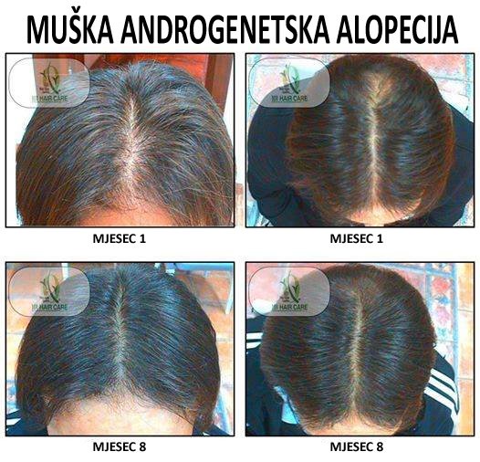 101 Hair Clinic - 101 Hair Clinic