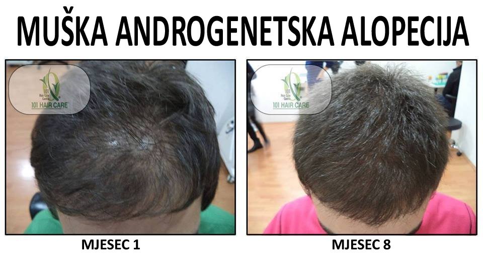 101 Hair Clinic - 101 Hair Clinic