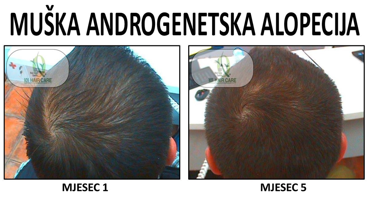 101 Hair Clinic - 101 Hair Clinic