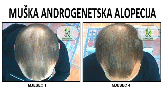 101 Hair Clinic - 101 Hair Clinic