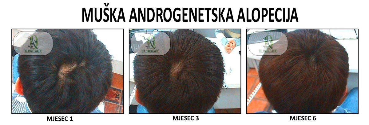 101 Hair Clinic - 101 Hair Clinic