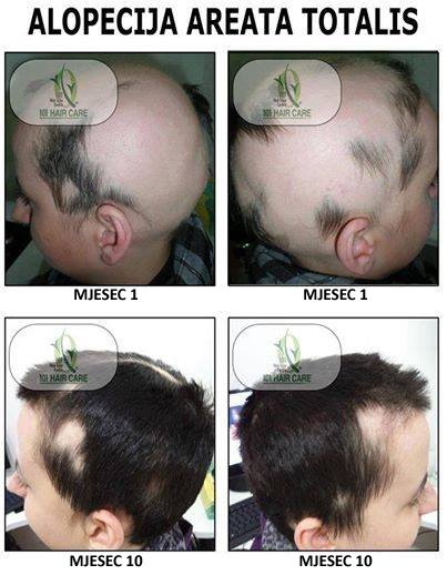 101 Hair Clinic - 101 Hair Clinic