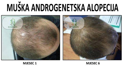 101 Hair Clinic - 101 Hair Clinic