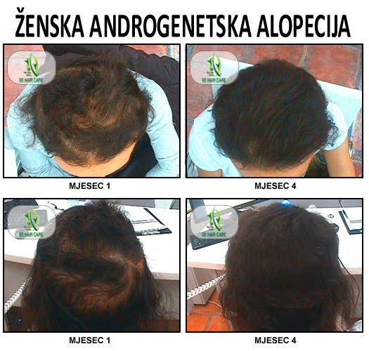 101 Hair Clinic - 101 Hair Clinic