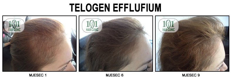 101 Hair Clinic - 101 Hair Clinic