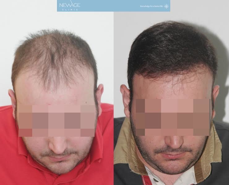 101 Hair Clinic - 101 Hair Clinic