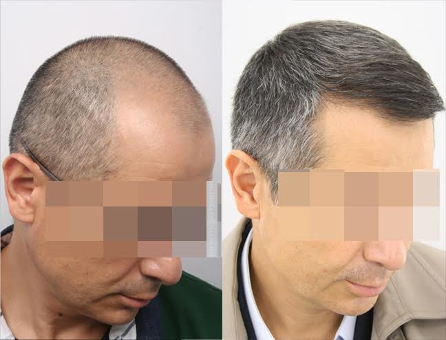 101 Hair Clinic - 101 Hair Clinic