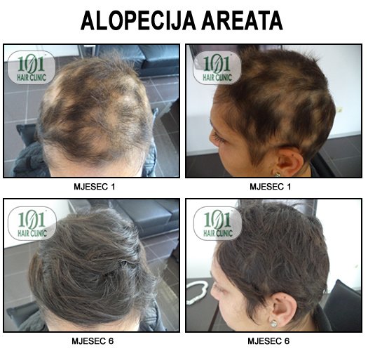 101 Hair Clinic - 101 Hair Clinic