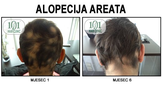 101 Hair Clinic - 101 Hair Clinic