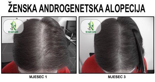 101 Hair Clinic - 101 Hair Clinic