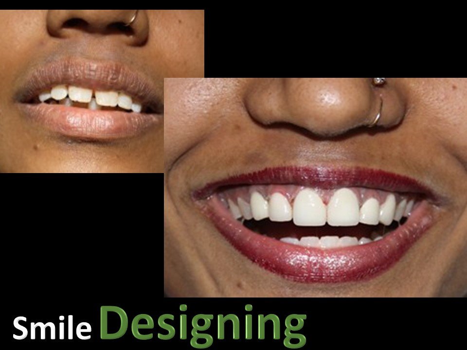 32 Pearls Multispeciality Dental Clinic - 32 Pearls Multispeciality Dental Clinic