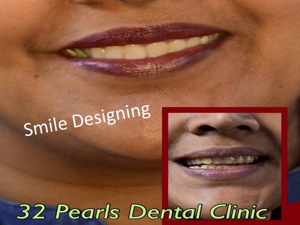 32 Pearls Multispeciality Dental Clinic - 32 Pearls Multispeciality Dental Clinic