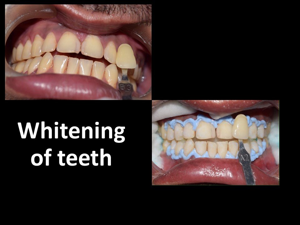 32 Pearls Multispeciality Dental Clinic - 32 Pearls Multispeciality Dental Clinic