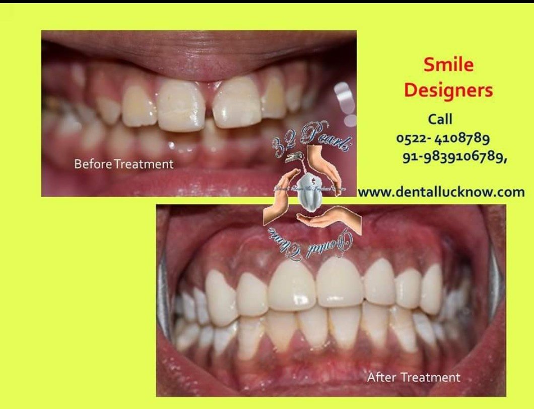 32 Pearls Multispeciality Dental Clinic - 32 Pearls Multispeciality Dental Clinic