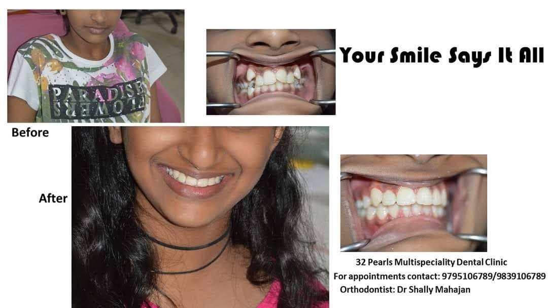 32 Pearls Multispeciality Dental Clinic - 32 Pearls Multispeciality Dental Clinic