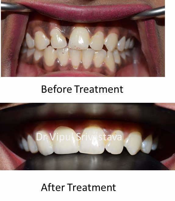 32 Pearls Multispeciality Dental Clinic - 32 Pearls Multispeciality Dental Clinic