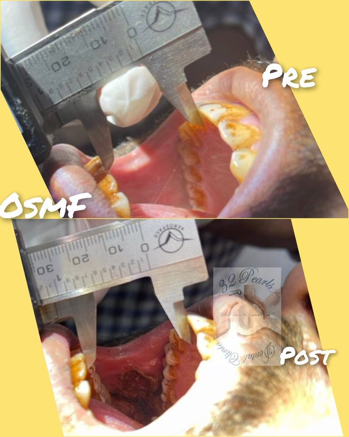 32 Pearls Multispeciality Dental Clinic - 32 Pearls Multispeciality Dental Clinic