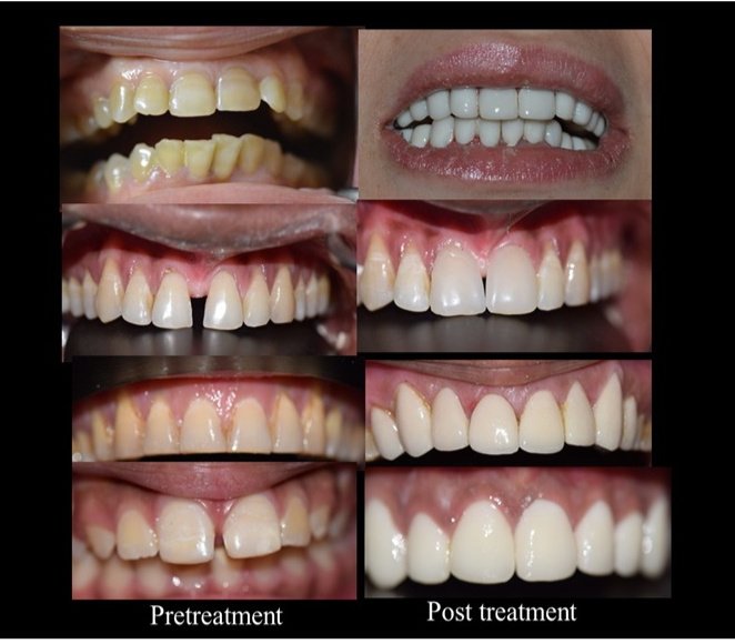 32 Pearls Multispeciality Dental Clinic - 32 Pearls Multispeciality Dental Clinic