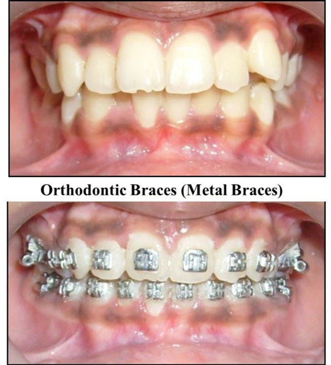 32 Pearls Multispeciality Dental Clinic - 32 Pearls Multispeciality Dental Clinic