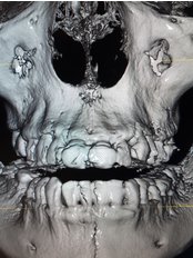 3D X-Ray in Nuevo Progreso - 3D X-Ray in Nuevo Progreso