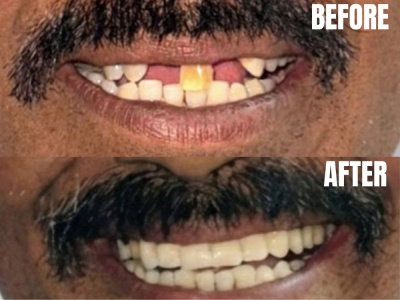 3D-DDS (Digital Dental Solutions) - 3D-DDS (Digital Dental Solutions)