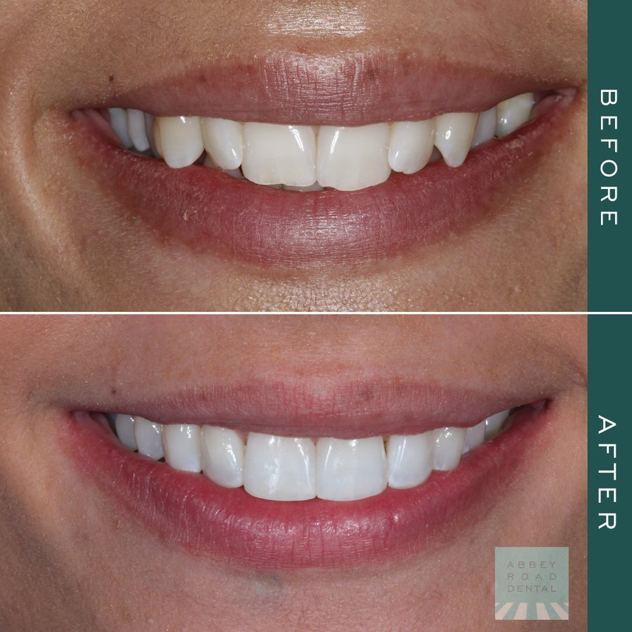 Abbey Road Dental Practice - Abbey Road Dental Practice