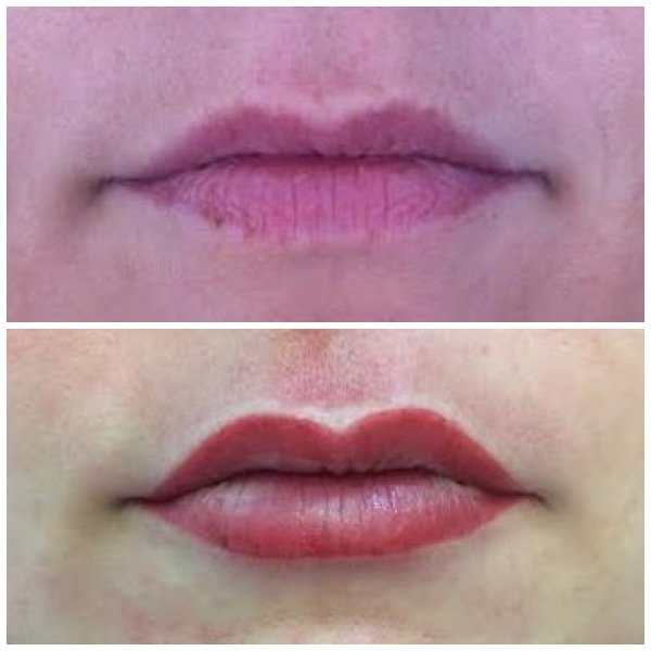 Abby Stacey - Advanced Skin Treatment - Bedlington - Abby Stacey - Advanced Skin Treatment - Bedlington