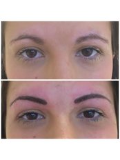 Abby Stacey - Advanced Skin Treatment - Bedlington - Abby Stacey - Advanced Skin Treatment - Bedlington