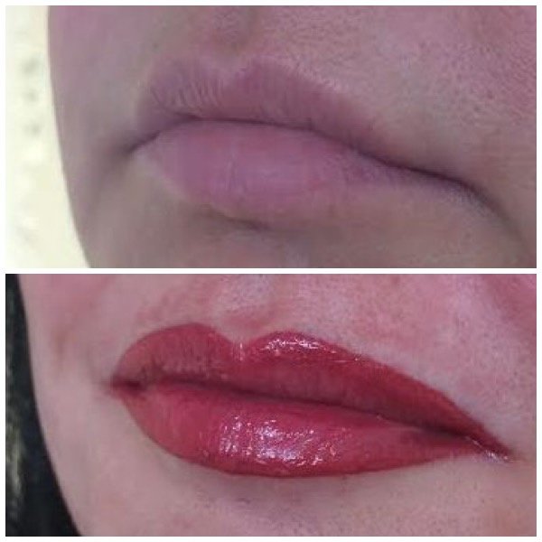 Abby Stacey - Advanced Skin Treatment - Bedlington - Abby Stacey - Advanced Skin Treatment - Bedlington