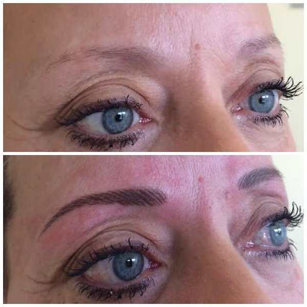 Abby Stacey - Advanced Skin Treatment - Bedlington - Abby Stacey - Advanced Skin Treatment - Bedlington