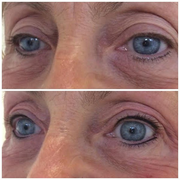 Abby Stacey - Advanced Skin Treatment - Bedlington - Abby Stacey - Advanced Skin Treatment - Bedlington