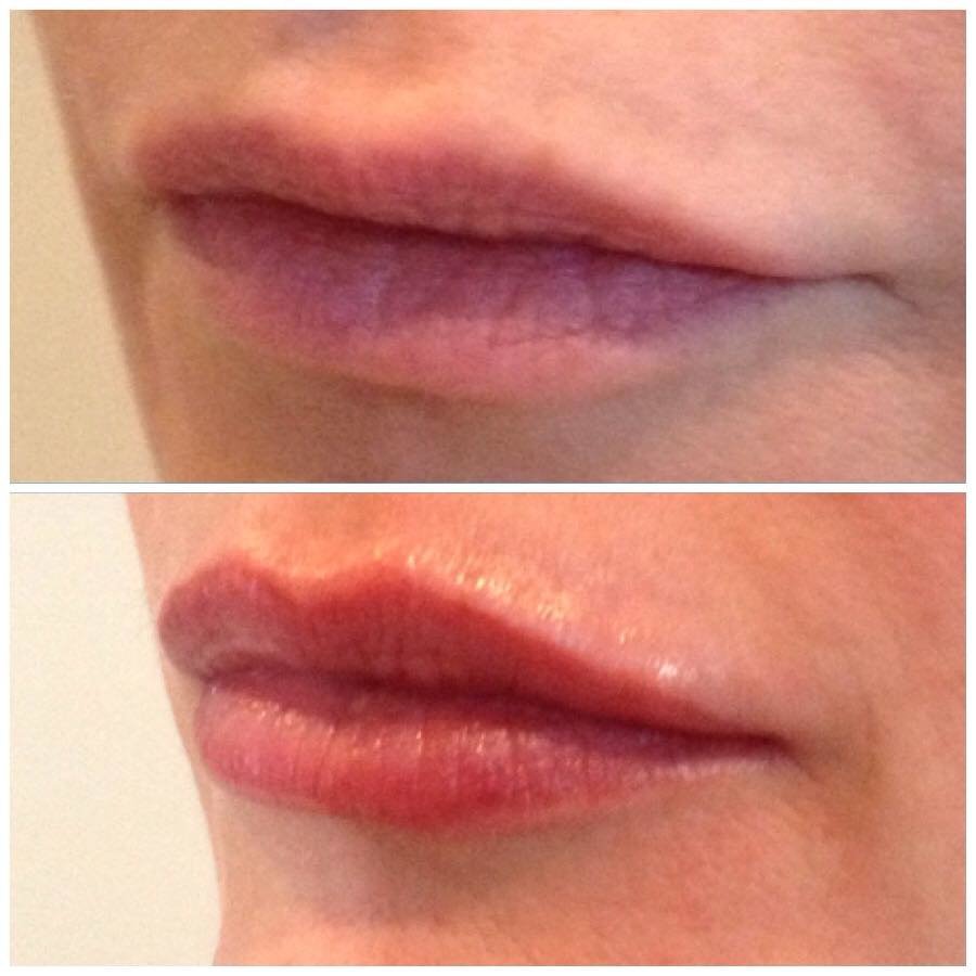 Abby Stacey - Advanced Skin Treatment - Bedlington - Abby Stacey - Advanced Skin Treatment - Bedlington