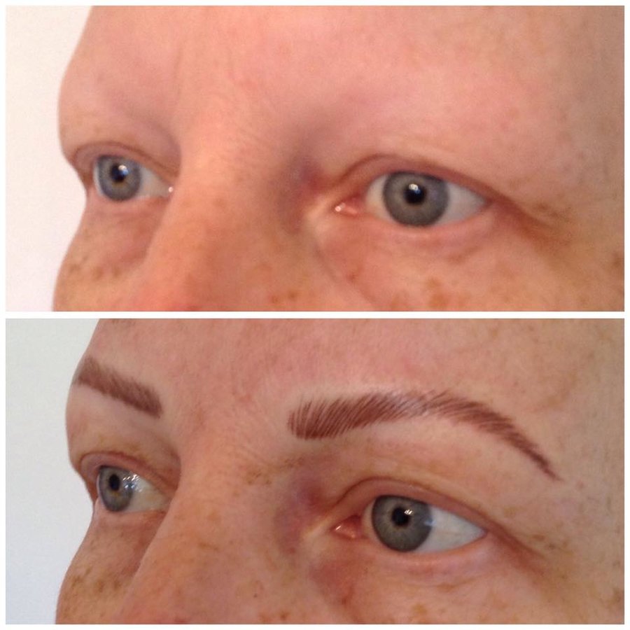 Abby Stacey - Advanced Skin Treatment - Bedlington - Abby Stacey - Advanced Skin Treatment - Bedlington
