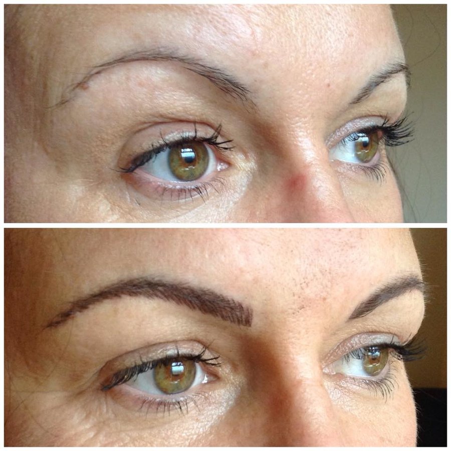 Abby Stacey - Advanced Skin Treatment - Bedlington - Abby Stacey - Advanced Skin Treatment - Bedlington