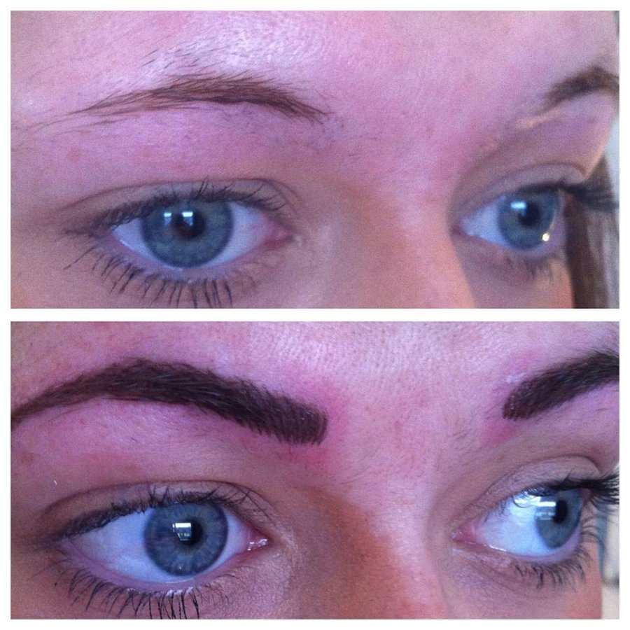 Abby Stacey - Advanced Skin Treatment - Bedlington - Abby Stacey - Advanced Skin Treatment - Bedlington