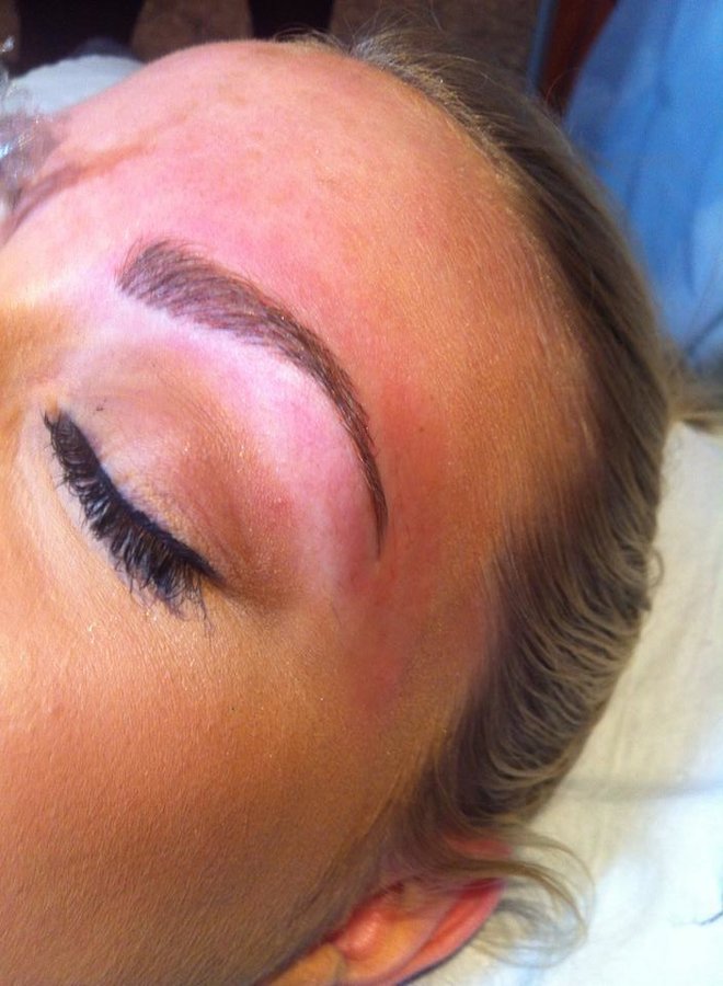 Abby Stacey - Advanced Skin Treatment - Bedlington - Abby Stacey - Advanced Skin Treatment - Bedlington
