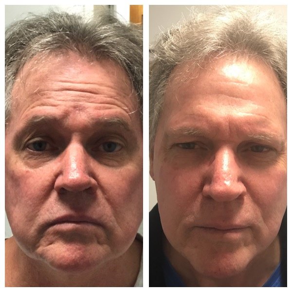 About Face Laser & Cosmedic Clinic - About Face Laser & Cosmedic Clinic