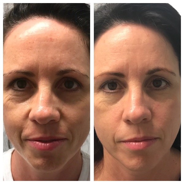 About Face Laser & Cosmedic Clinic - About Face Laser & Cosmedic Clinic