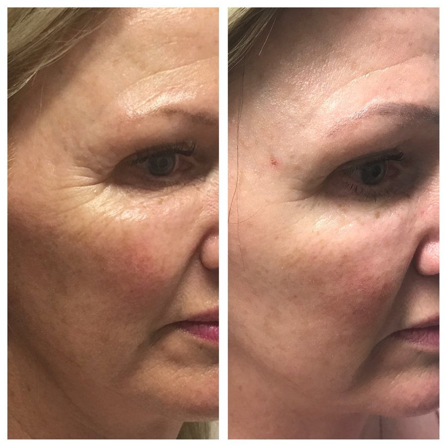 About Face Laser & Cosmedic Clinic - About Face Laser & Cosmedic Clinic