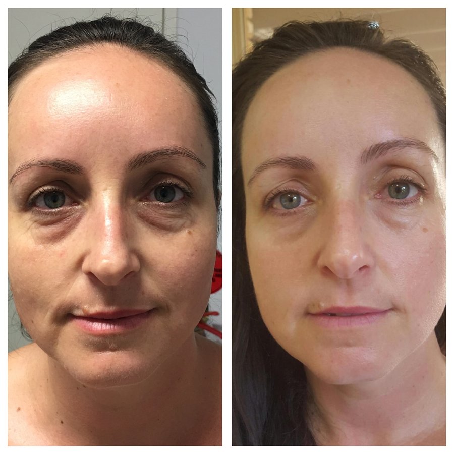 About Face Laser & Cosmedic Clinic - About Face Laser & Cosmedic Clinic